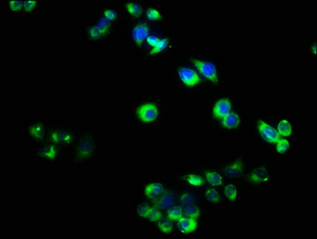 Immunofluorescence staining of PC-3 cells with CSB-PA08179A0Rb at 1:40, counter-stained with DAPI. The cells were fixed in 4% formaldehyde, permeabilized using 0.2% Triton X-100 and blocked in 10% normal Goat Serum. The cells were then incubated with the antibody overnight at 4&deg;C. The secondary antibody was Alexa Fluor 488-congugated AffiniPure Goat Anti-Rabbit IgG(H+L).