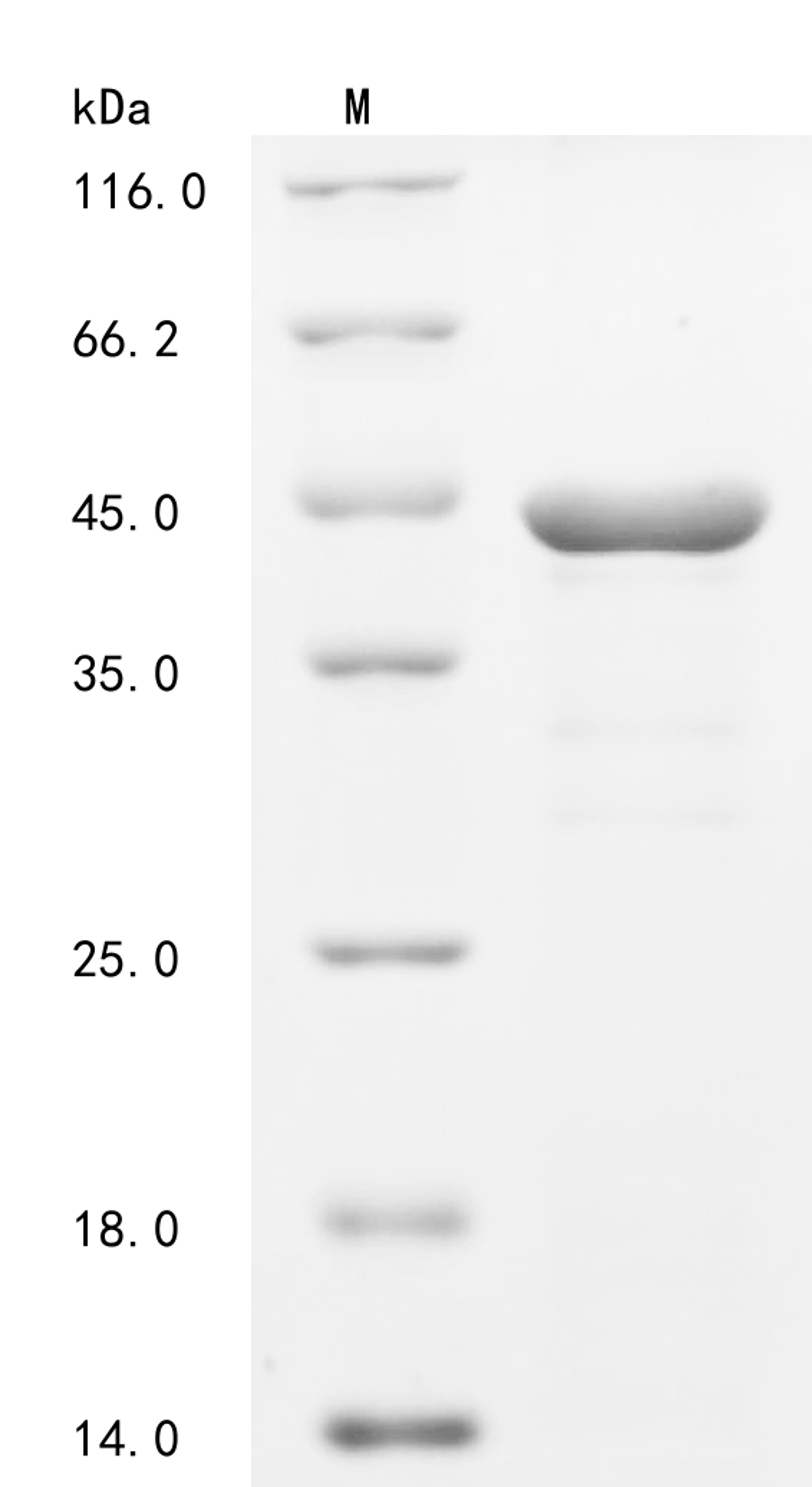 (Tris-Glycine gel) Discontinuous SDS-PAGE (reduced) with 5% enrichment gel and 15% separation gel.