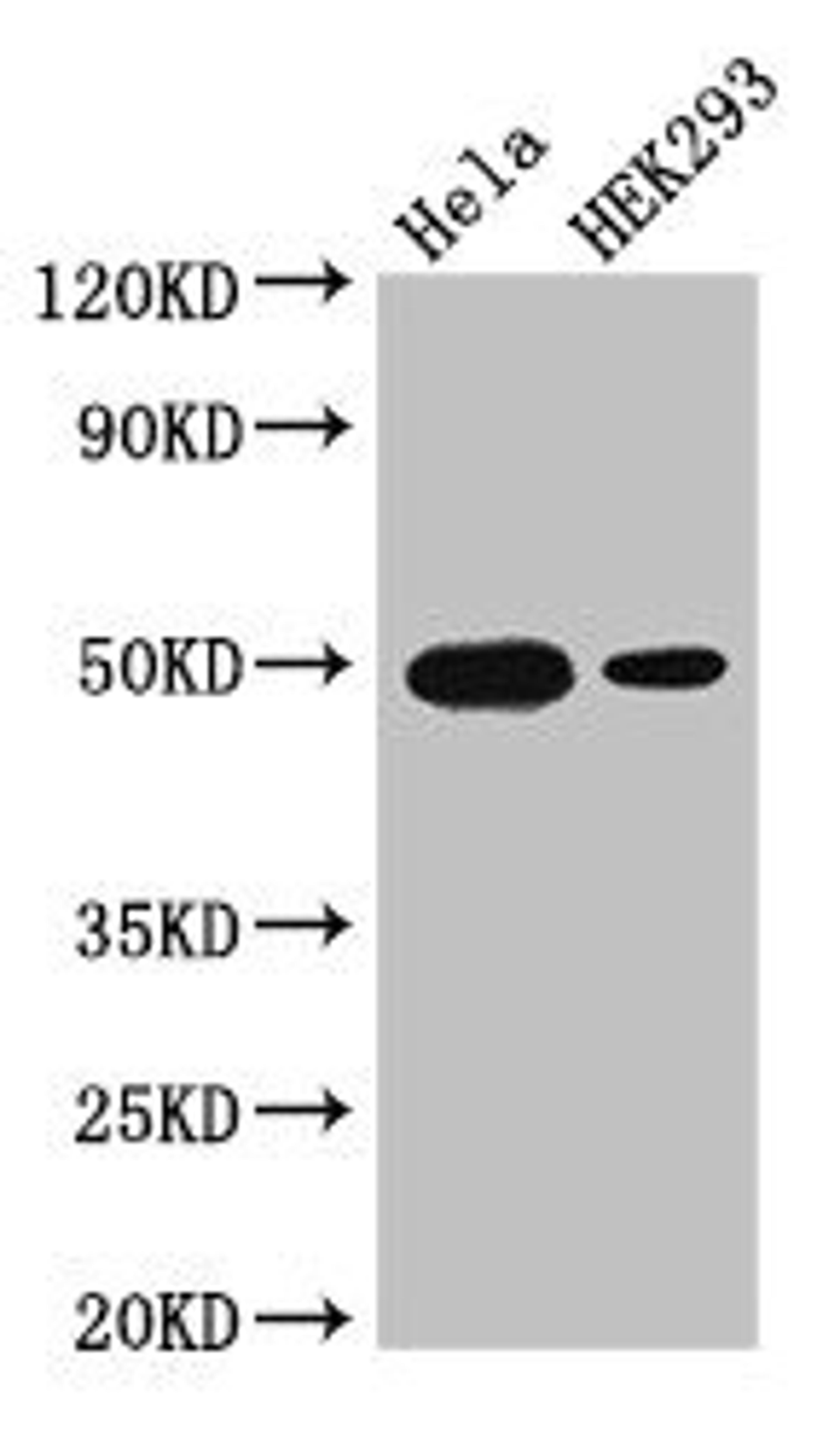 Western Blot. Positive WB detected in: Hela whole cell lysate, HEK293 whole cell lysate. All lanes: JUND antibody at 3µg/ml. Secondary. Goat polyclonal to rabbit IgG at 1/50000 dilution. Predicted band size: 36 kDa. Observed band size: 50 kDa