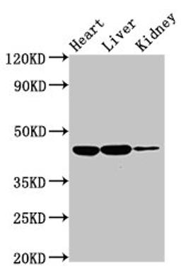 Western Blot. Positive WB detected in: Rat heart tissue, Rat liver tissue, Rat kidney tissue. All lanes: IL10RB antibody at 2ug/ml. Secondary. Goat polyclonal to rabbit IgG at 1/50000 dilution. Predicted band size: 37 kDa. Observed band size: 45 kDa. 