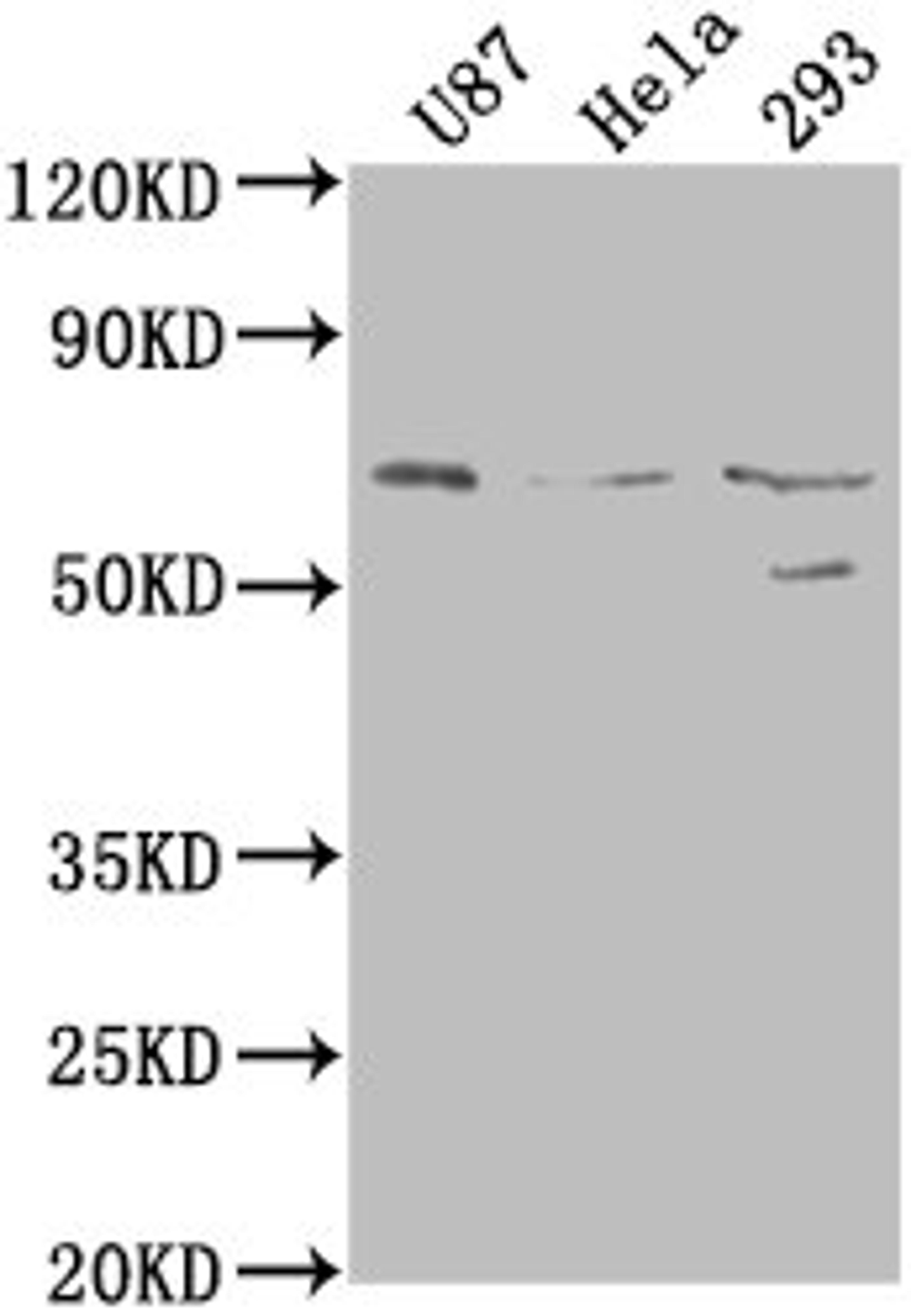 Western Blot. Positive WB detected in: U87 whole cell lysate, Hela whole cell lysate, 293 whole cell lysate. All lanes: PTGS2 antibody at 1:1000. Secondary. Goat polyclonal to rabbit IgG at 1/50000 dilution. Predicted band size: 69 kDa. Observed band size: 69 kDa. 
