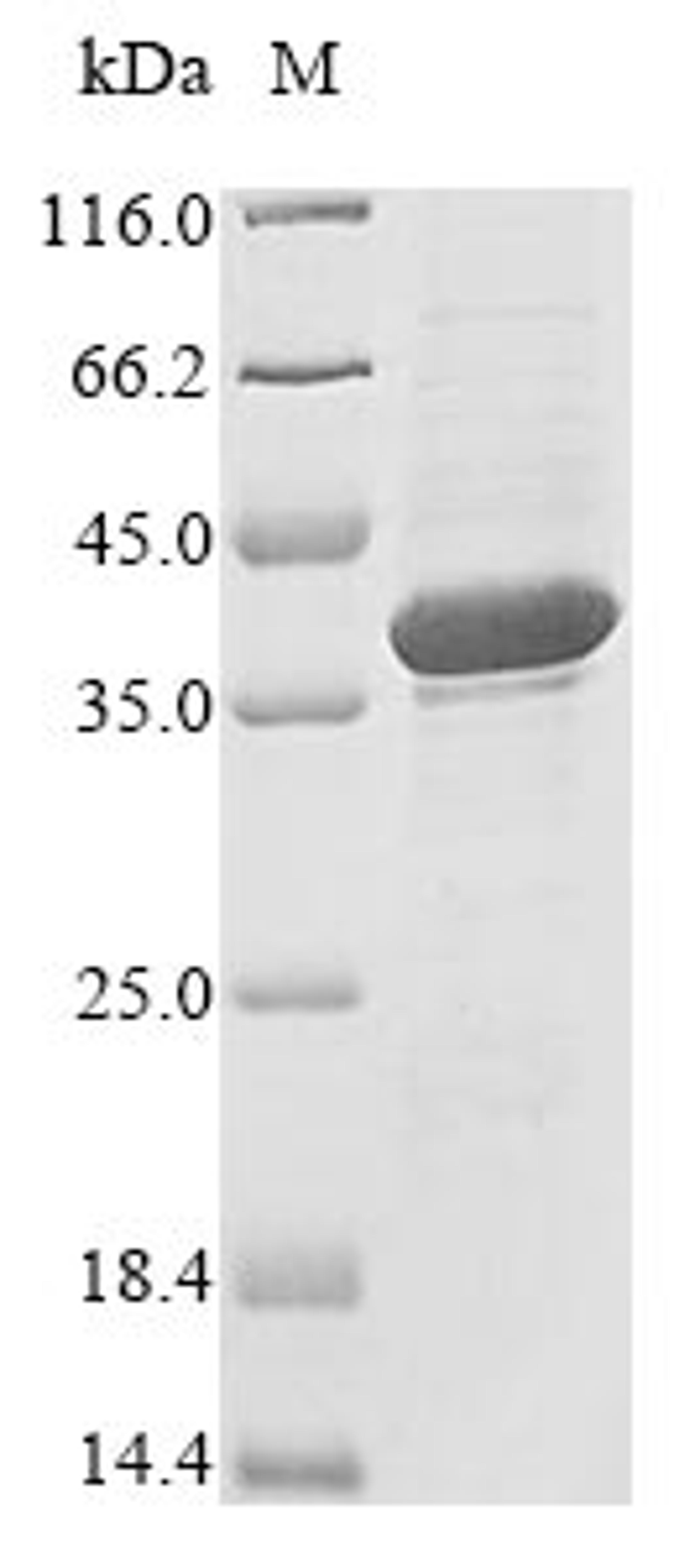 (Tris-Glycine gel) Discontinuous SDS-PAGE (reduced) with 5% enrichment gel and 15% separation gel.