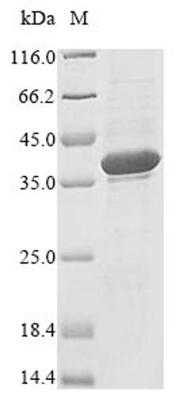(Tris-Glycine gel) Discontinuous SDS-PAGE (reduced) with 5% enrichment gel and 15% separation gel.