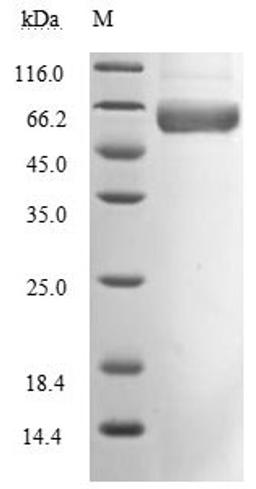 (Tris-Glycine gel) Discontinuous SDS-PAGE (reduced) with 5% enrichment gel and 15% separation gel. Predicted band size: 51.1 kDa Observed band size: 66 kDa due to glycosylation