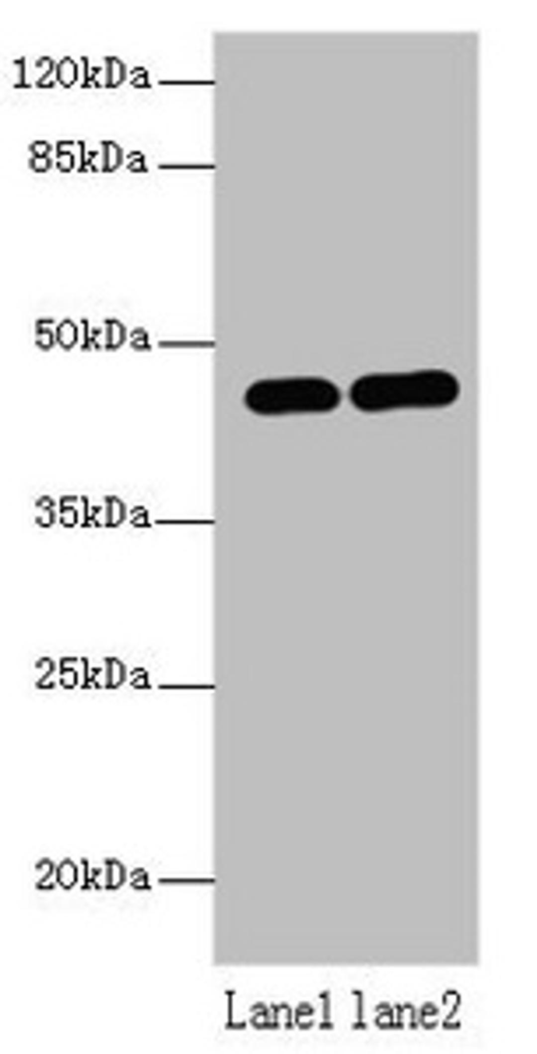 Western blot. All lanes: LMNTD1 antibody at 12µg/ml. Lane 1: MCF-7 whole cell lysate. Lane 2: Mouse liver tissue. Secondary. Goat polyclonal to rabbit IgG at 1/10000 dilution. Predicted band size: 44, 34, 37, 42, 46 kDa. Observed band size: 44 kDa
