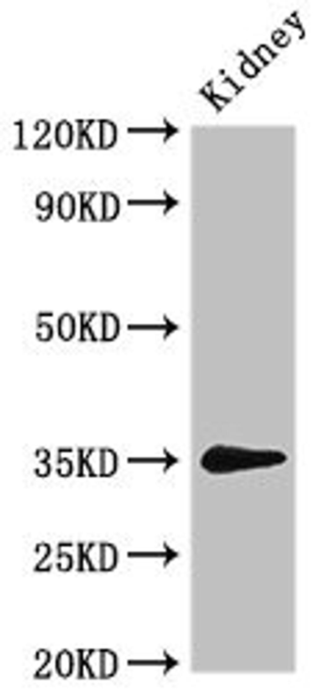 Western Blot. Positive WB detected in: Rat kidney tissue. All lanes: PRPS2 antibody at 3ug/ml. Secondary. Goat polyclonal to rabbit IgG at 1/50000 dilution. Predicted band size: 35, 36 kDa. Observed band size: 35 kDa. 