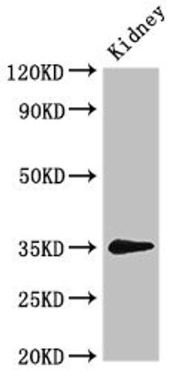 Western Blot. Positive WB detected in: Rat kidney tissue. All lanes: PRPS2 antibody at 3ug/ml. Secondary. Goat polyclonal to rabbit IgG at 1/50000 dilution. Predicted band size: 35, 36 kDa. Observed band size: 35 kDa. 