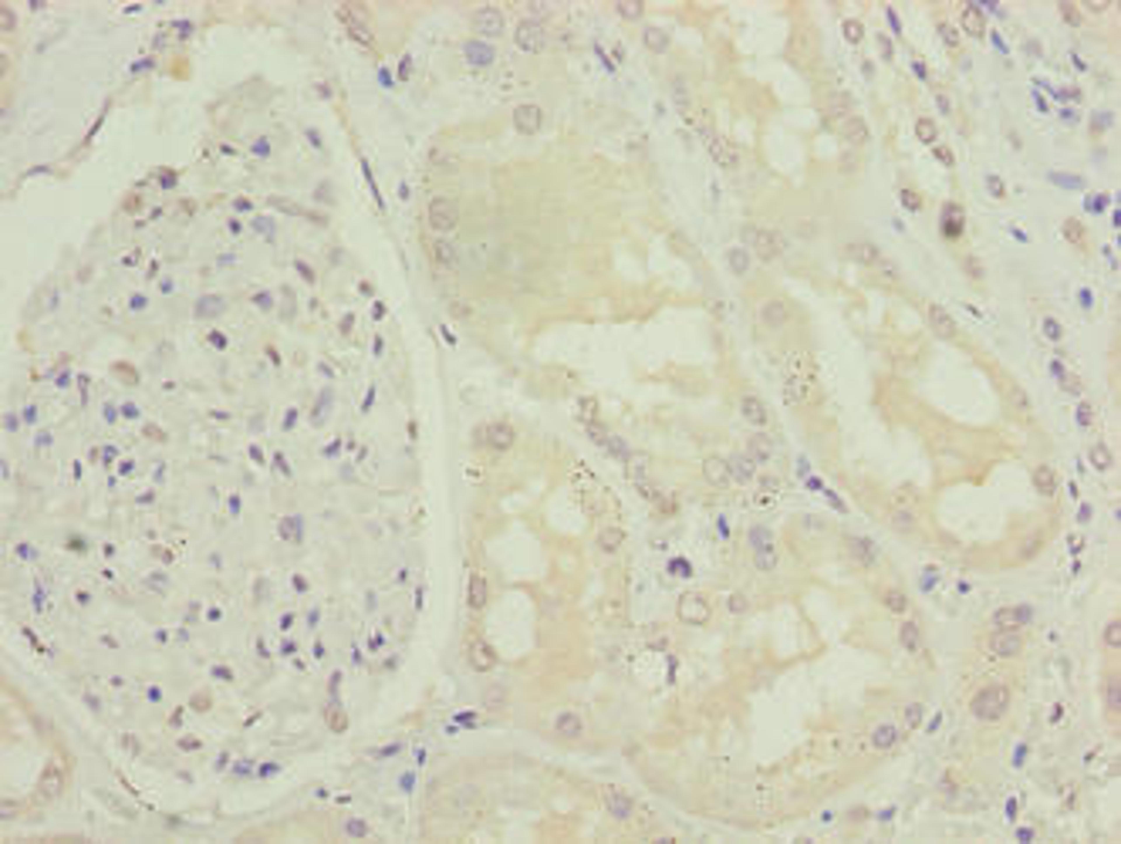 Immunohistochemistry of paraffin-embedded human kidney tissue using CSB-PA740915LA01HU at dilution of 1:100