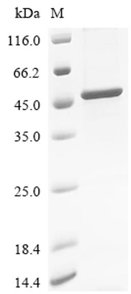 (Tris-Glycine gel) Discontinuous SDS-PAGE (reduced) with 5% enrichment gel and 15% separation gel.