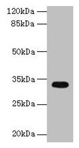 Western blot. All lanes: CYB5R2 antibody at 4µg/ml + Mouse kidney tissue. Secondary. Goat polyclonal to rabbit IgG at 1/10000 dilution. Predicted band size: 32, 28 kDa. Observed band size: 32 kDa