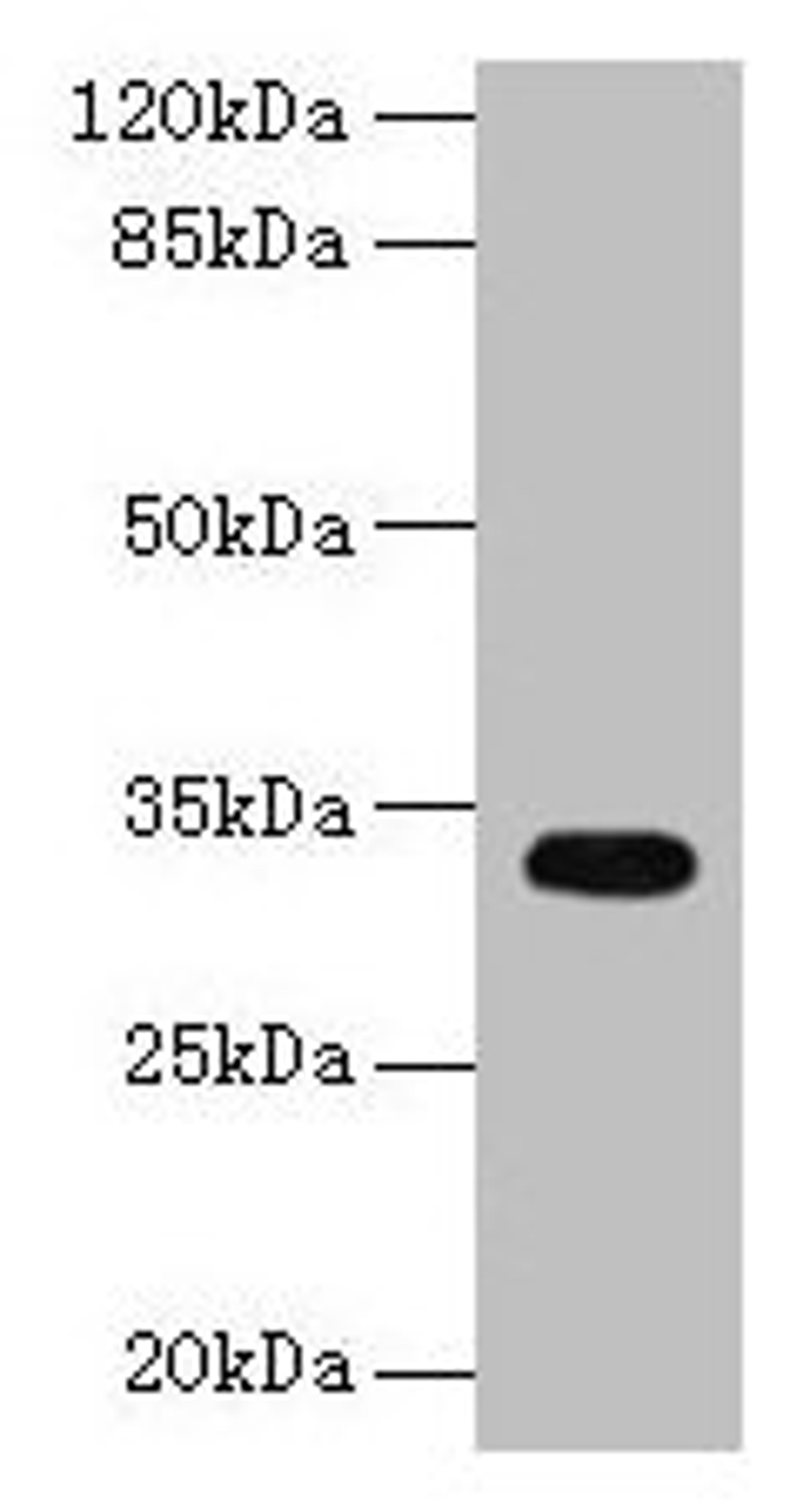 Western blot. All lanes: CYB5R2 antibody at 4µg/ml + Mouse kidney tissue. Secondary. Goat polyclonal to rabbit IgG at 1/10000 dilution. Predicted band size: 32, 28 kDa. Observed band size: 32 kDa