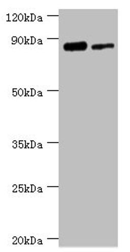 Western blot. All lanes: TFIIH basal transcription factor complex helicase XPD subunit antibody at 2ug/ml. Lane 1: 293T whole cell lysate. Lane 2: K562 whole cell lysate. Secondary. Goat polyclonal to rabbit IgG at 1/10000 dilution. Predicted band size: 87, 47 kDa. Observed band size: 87 kDa. 