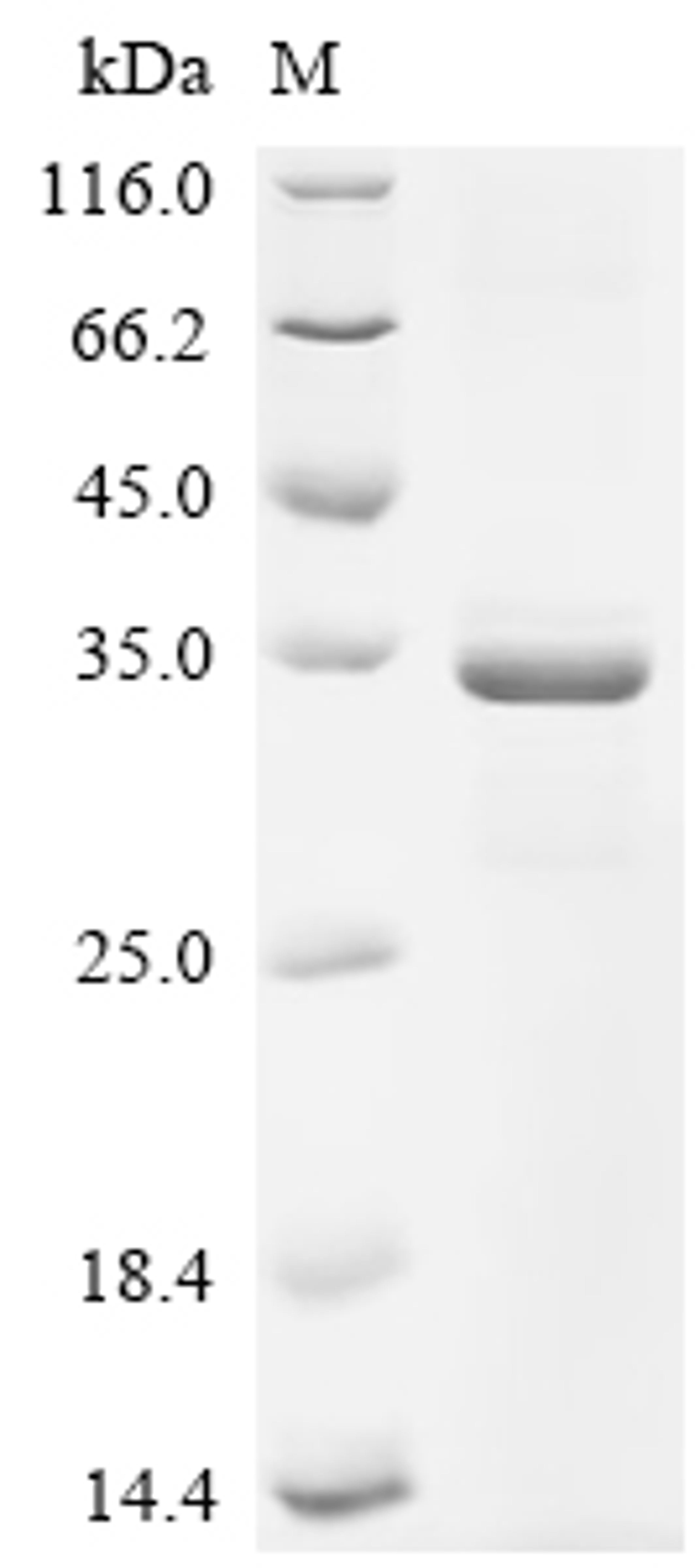 (Tris-Glycine gel) Discontinuous SDS-PAGE (reduced) with 5% enrichment gel and 15% separation gel.
