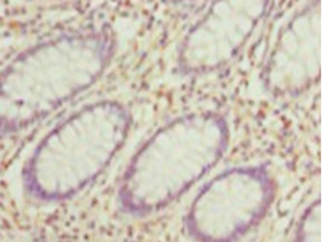 Immunohistochemistry of paraffin-embedded human testis tissue using CSB-PA17869A0Rb at dilution of 1: 100