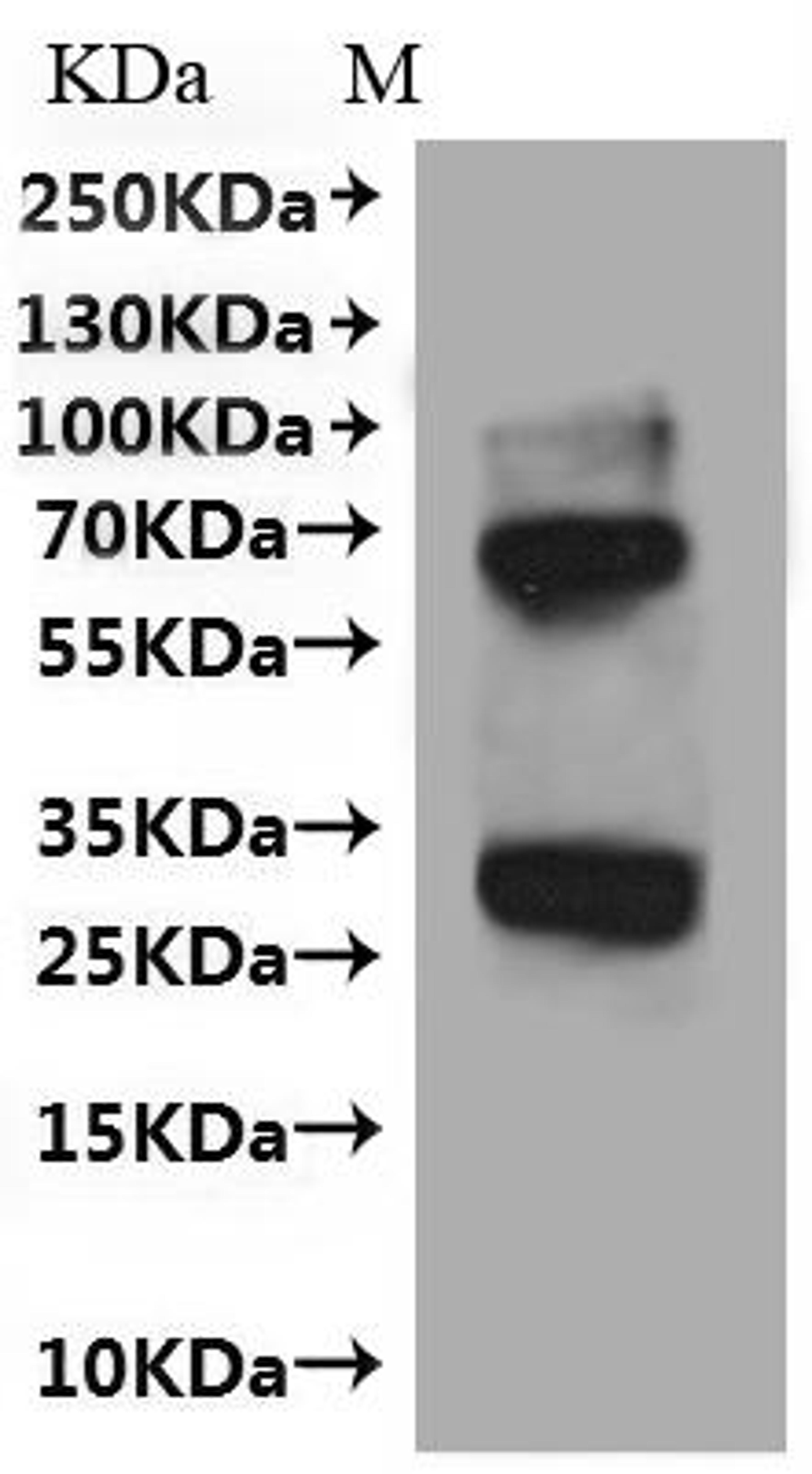 (Tris-Glycine gel) Discontinuous SDS-PAGE (reduced) with 5% enrichment gel and 15% separation gel.