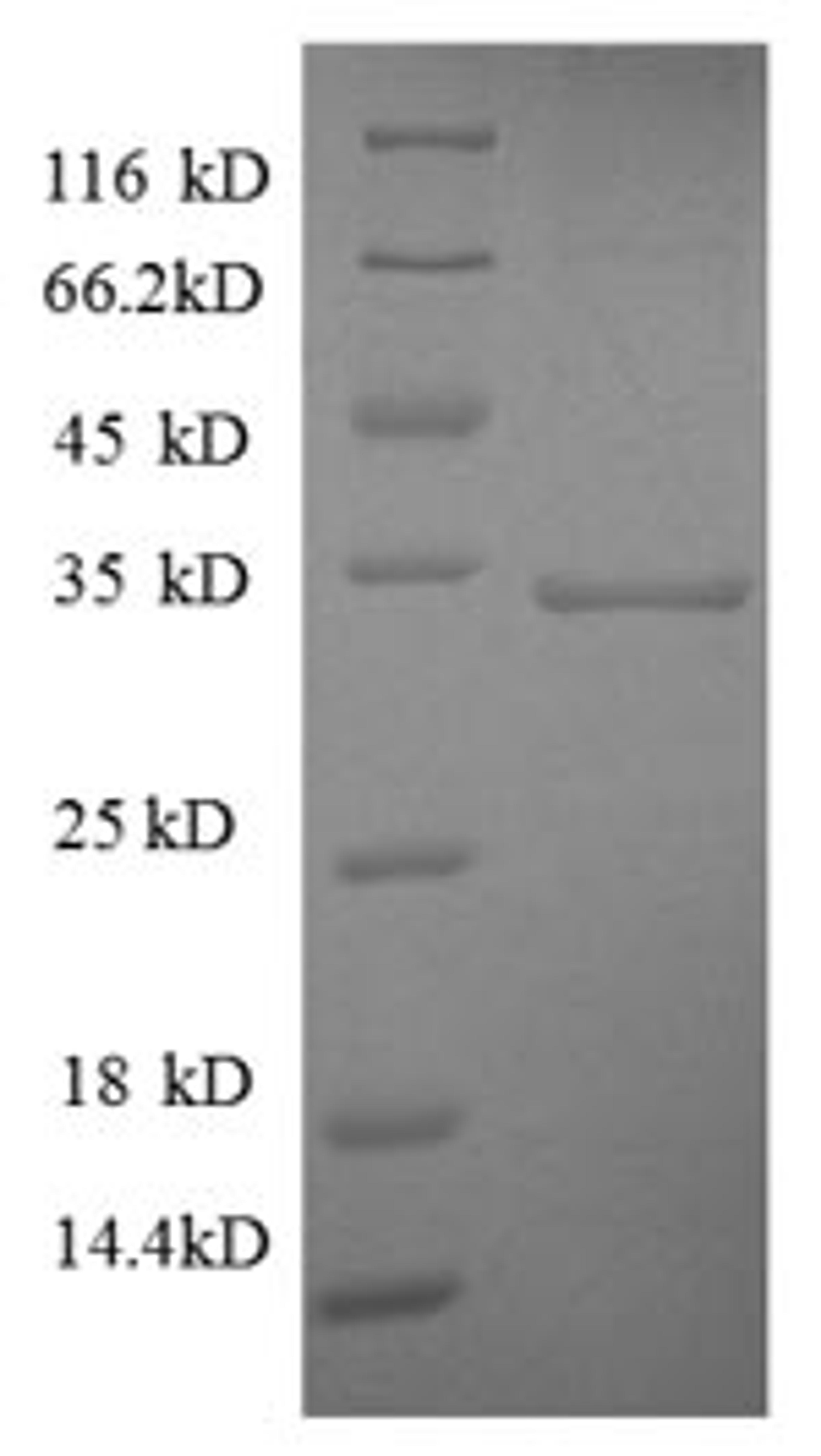 (Tris-Glycine gel) Discontinuous SDS-PAGE (reduced) with 5% enrichment gel and 15% separation gel.