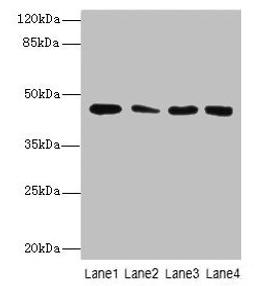 Western Blot. All lanes: CBWD2 antibody at 6µg/ml. Lane 1: Mouse heart tissue. Lane 2: Mouse liver tissue. Lane 3: Mouse lung tissue. Lane 4: Hela whole cell lysate. Secondary. Goat polyclonal to rabbit IgG at 1/10000 dilution. Predicted band size: 45 kDa. Observed band size: 45 kDa