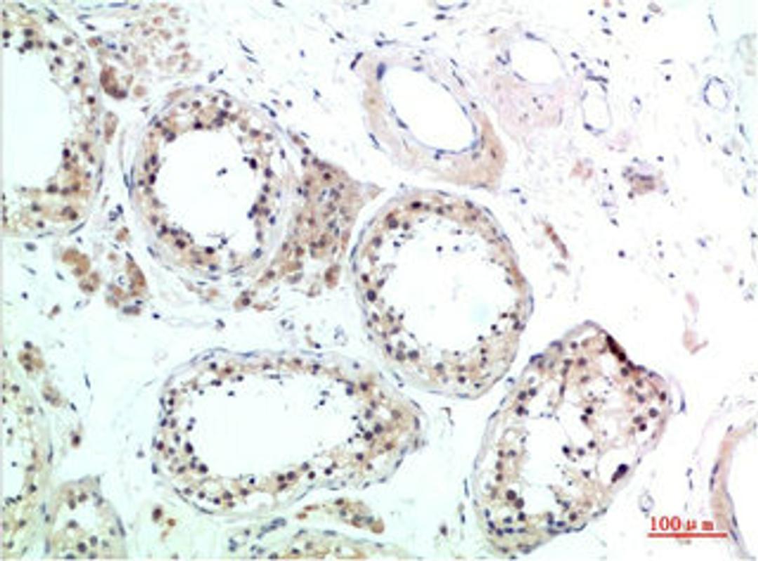 Immunohistochemical analysis of paraffin-embedded Human Testis Tissue using HSC70 Rabbit pAb diluted at 1:200