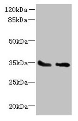 Western blot. All lanes: SLC25A36 antibody at 4µg/ml. Lane 1: A431 whole cell lysate. Lane 2: A549 whole cell lysate. Secondary. Goat polyclonal to rabbit IgG at 1/10000 dilution. Predicted band size: 35, 15, 18 kDa. Observed band size: 35 kDa
