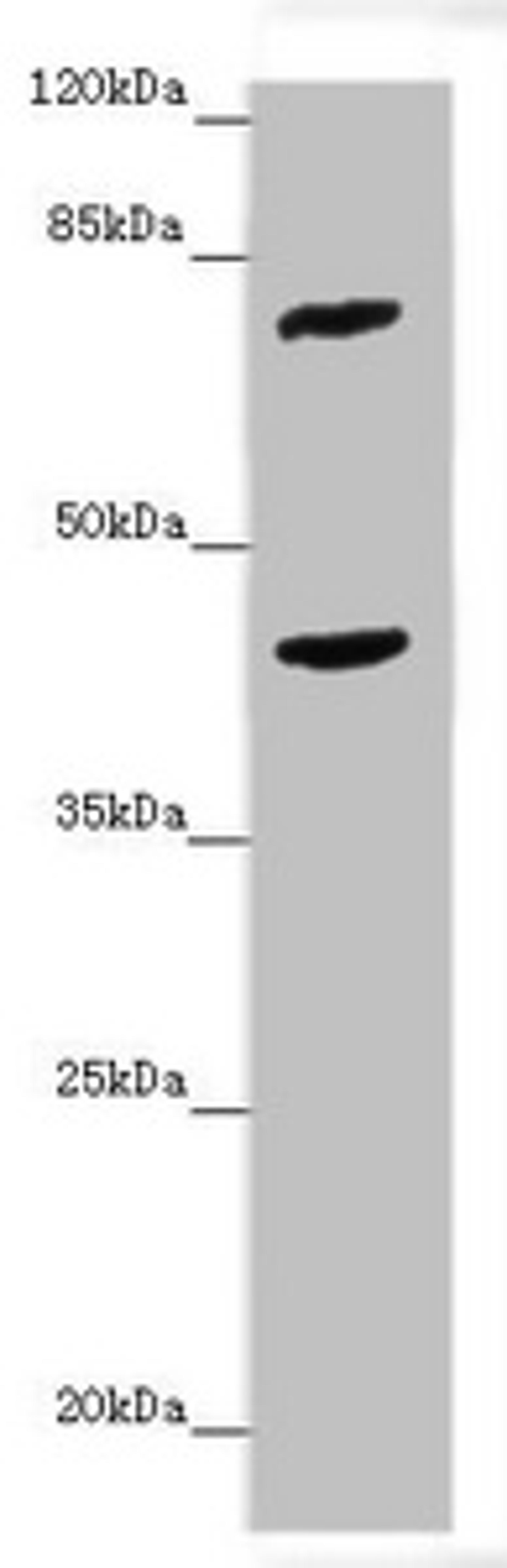 Western blot. All lanes: ACSL6 antibody at 4.25 ug/ml + Mouse liver tissue. Secondary. Goat polyclonal to rabbit IgG at 1/10000 dilution. Predicted band size: 78, 81, 75, 77, 80, 70 kDa. Observed band size: 78, 42 kDa. 