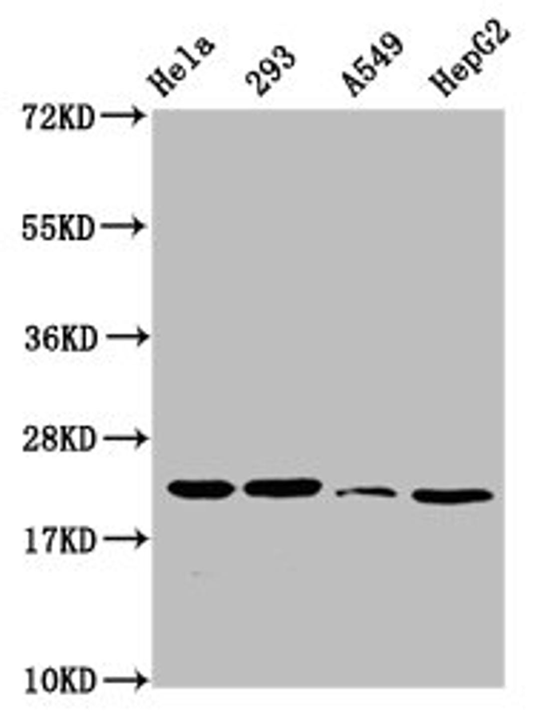 Western Blot. Positive WB detected in: Hela whole cell lysate, 293 whole cell lysate, A549 whole cell lysate, HepG2 whole cell lysate. All lanes: HIST1H1D antibody at 1.6µg/ml. Secondary. Goat polyclonal to rabbit IgG at 1/50000 dilution. Predicted band size: 23 kDa. Observed band size: 23 kDa