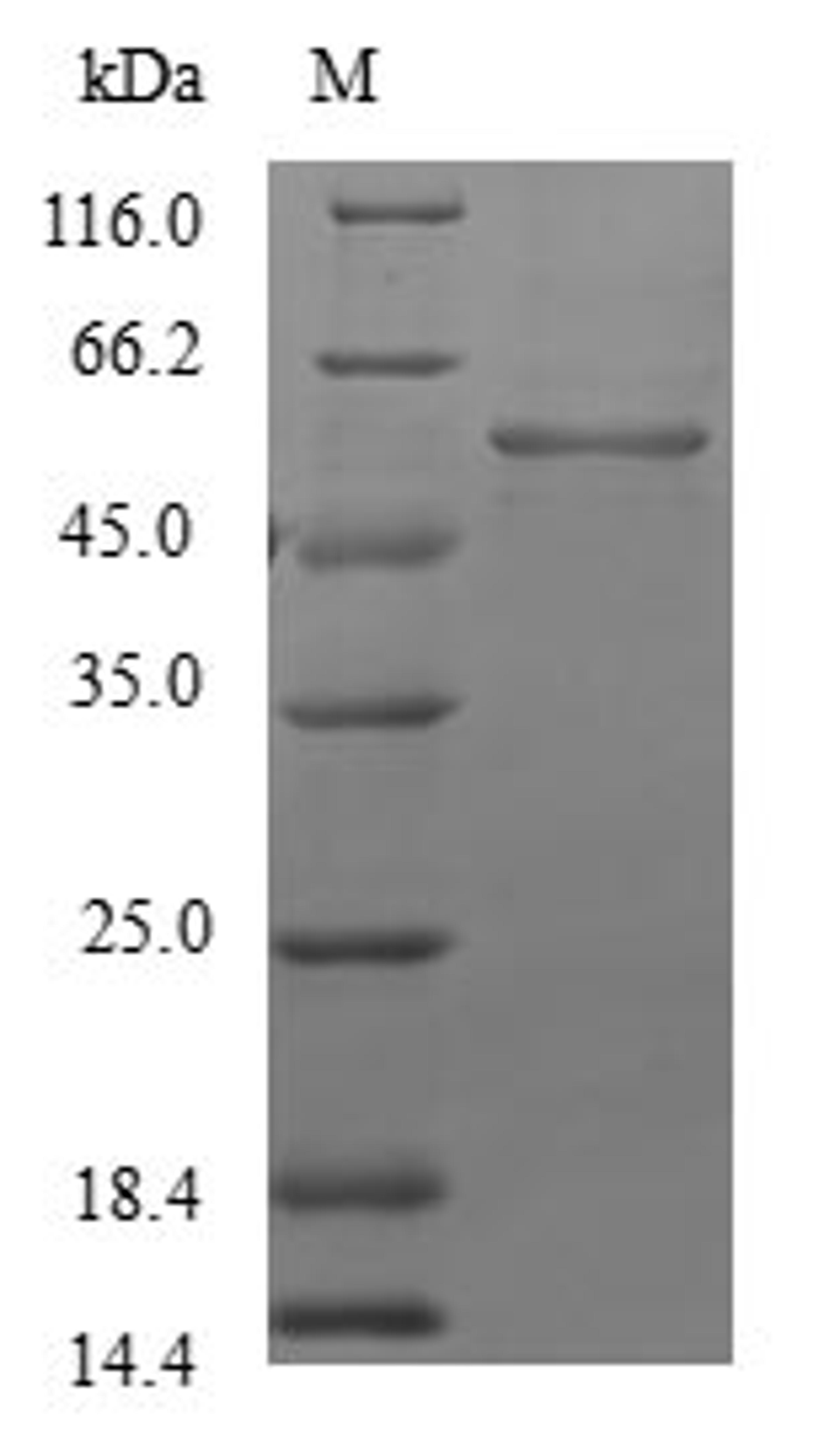 (Tris-Glycine gel) Discontinuous SDS-PAGE (reduced) with 5% enrichment gel and 15% separation gel.