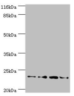 Western blot. All lanes: Fxn antibody at 2µg/ml. Lane 1: HepG2 whole cell lysate. Lane 2: Hela whole cell lysate. Lane 3: Mouse brain tissue. Lane 4: Jurkat whole cell lysate. Secondary. Goat polyclonal to rabbit IgG at 1/10000 dilution. Predicted band size: 23 kDa. Observed band size: 23 kDa