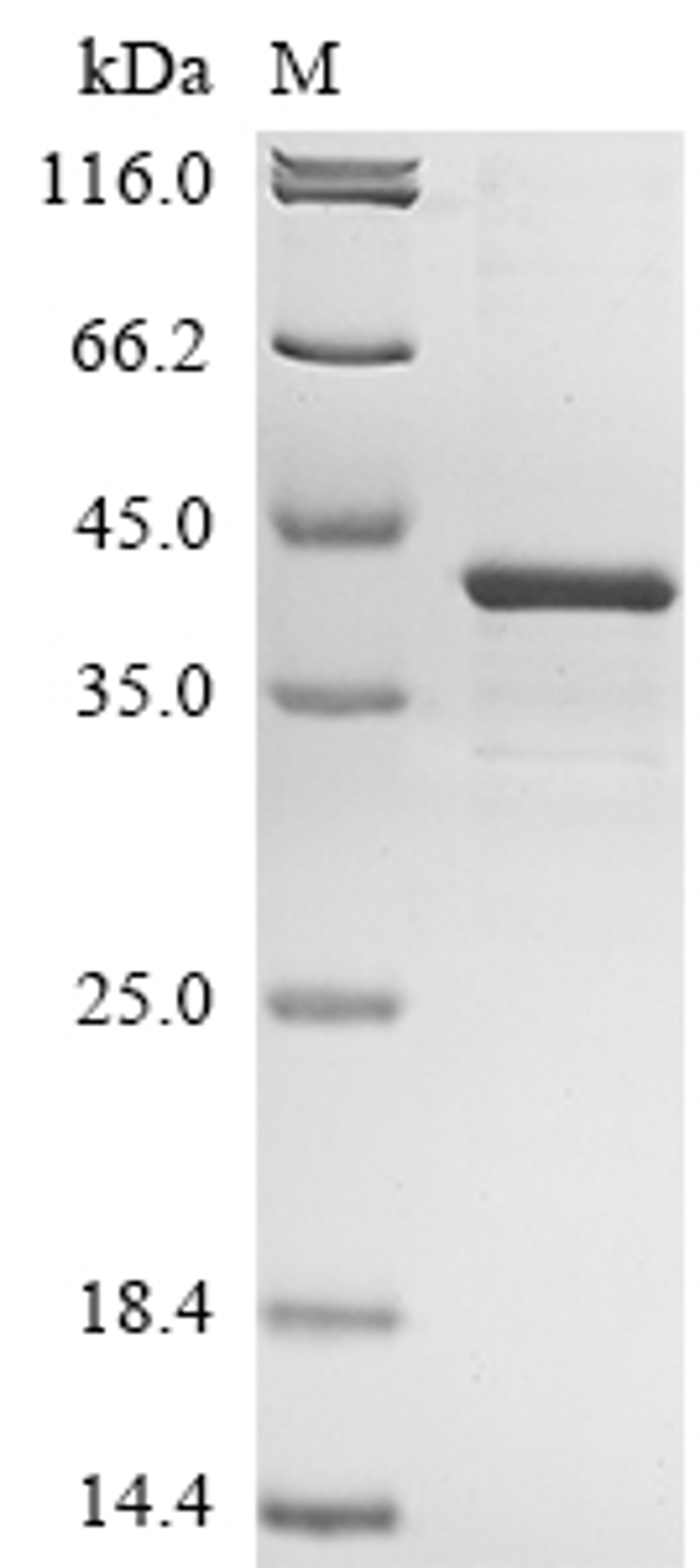 (Tris-Glycine gel) Discontinuous SDS-PAGE (reduced) with 5% enrichment gel and 15% separation gel.