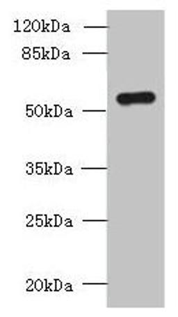 Western blot. All lanes: SLC38A2 antibody at 1.5µg/ml + A431 whole cell lysate. Secondary. Goat polyclonal to rabbit IgG at 1/10000 dilution. Predicted band size: 57, 46 kDa. Observed band size: 57 kDa