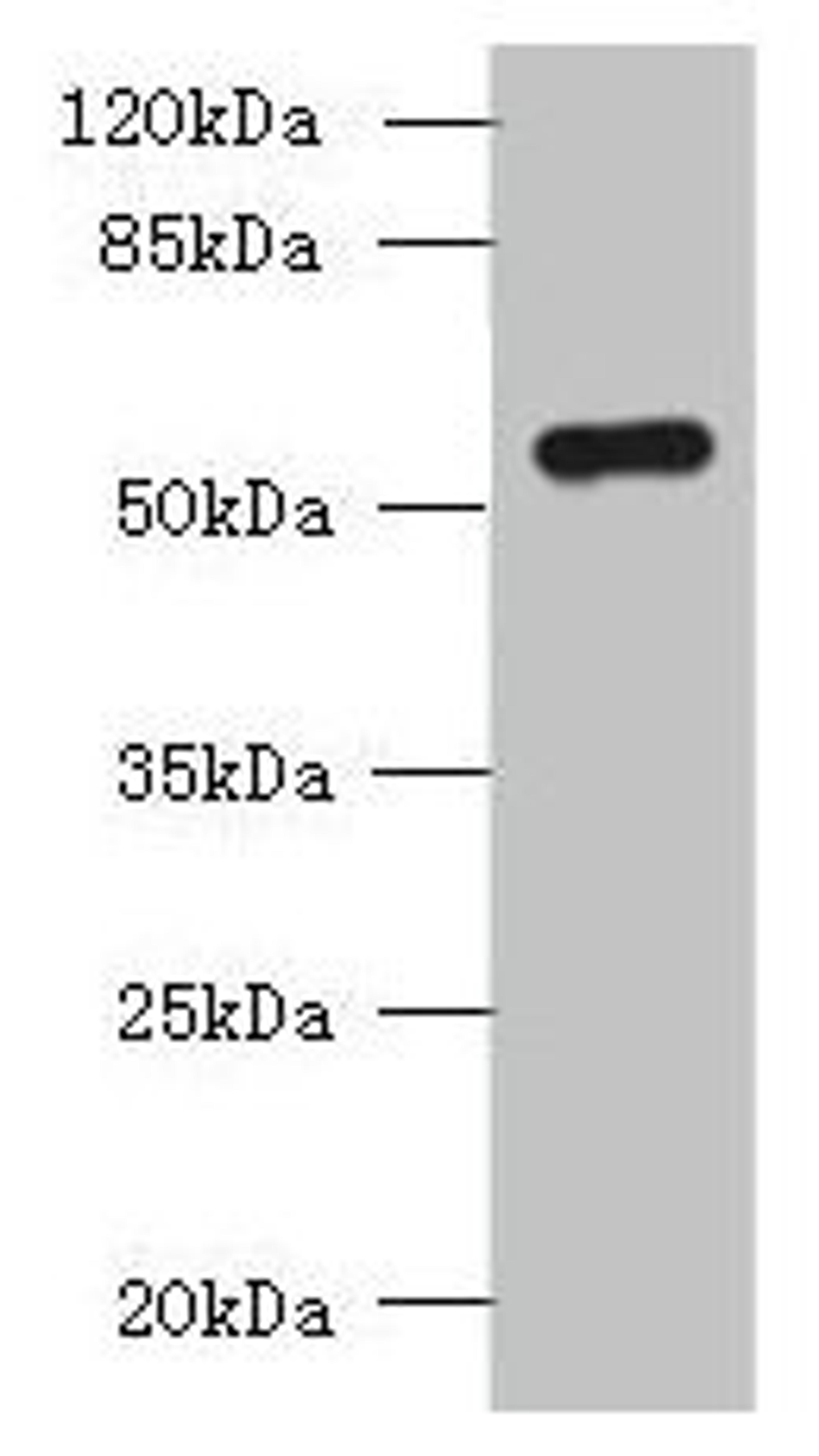Western blot. All lanes: SLC38A2 antibody at 1.5µg/ml + A431 whole cell lysate. Secondary. Goat polyclonal to rabbit IgG at 1/10000 dilution. Predicted band size: 57, 46 kDa. Observed band size: 57 kDa