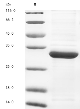 (Tris-Glycine gel) Discontinuous SDS-PAGE (reduced) with 5% enrichment gel and 15% separation gel.
