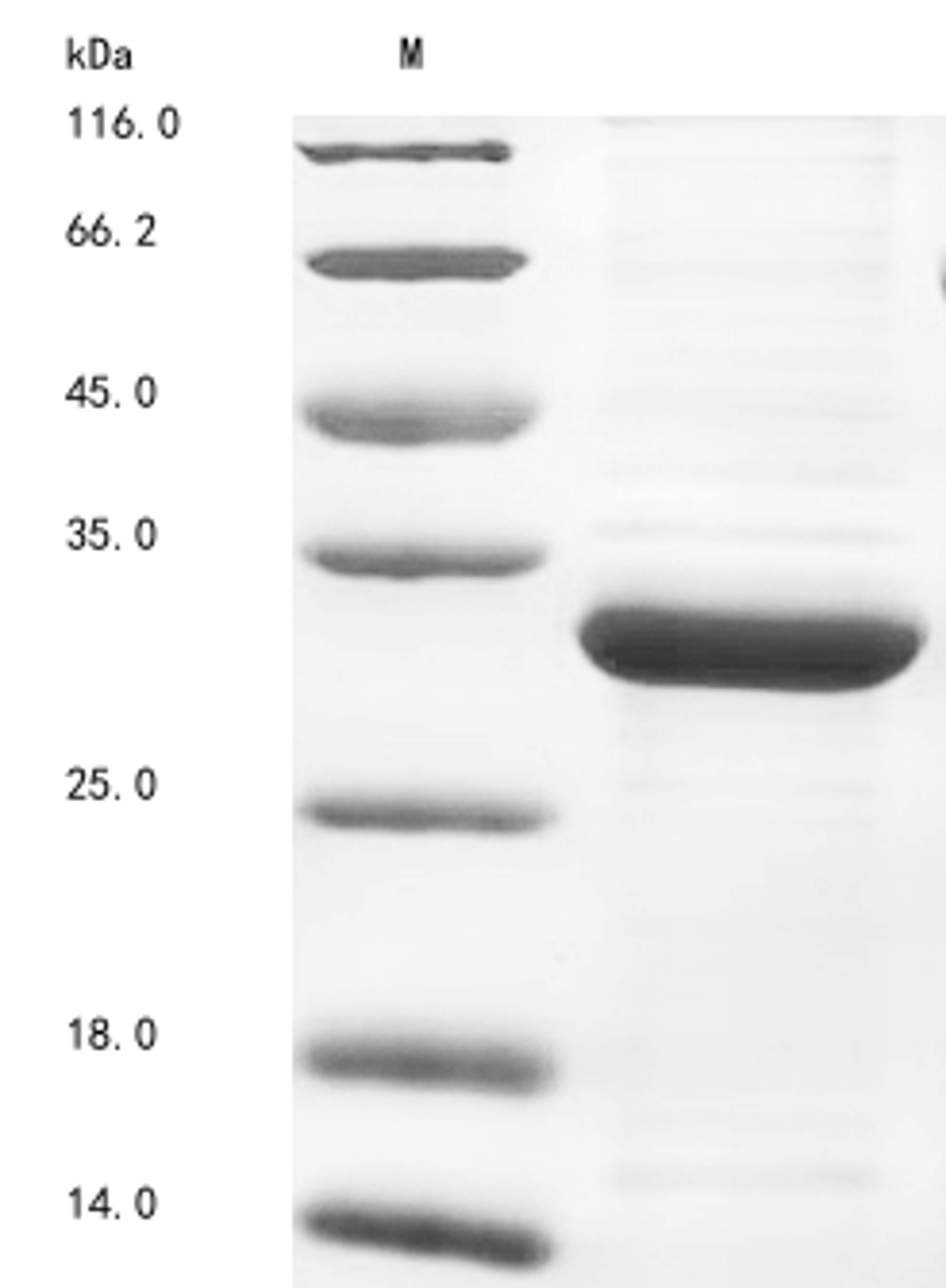 (Tris-Glycine gel) Discontinuous SDS-PAGE (reduced) with 5% enrichment gel and 15% separation gel.