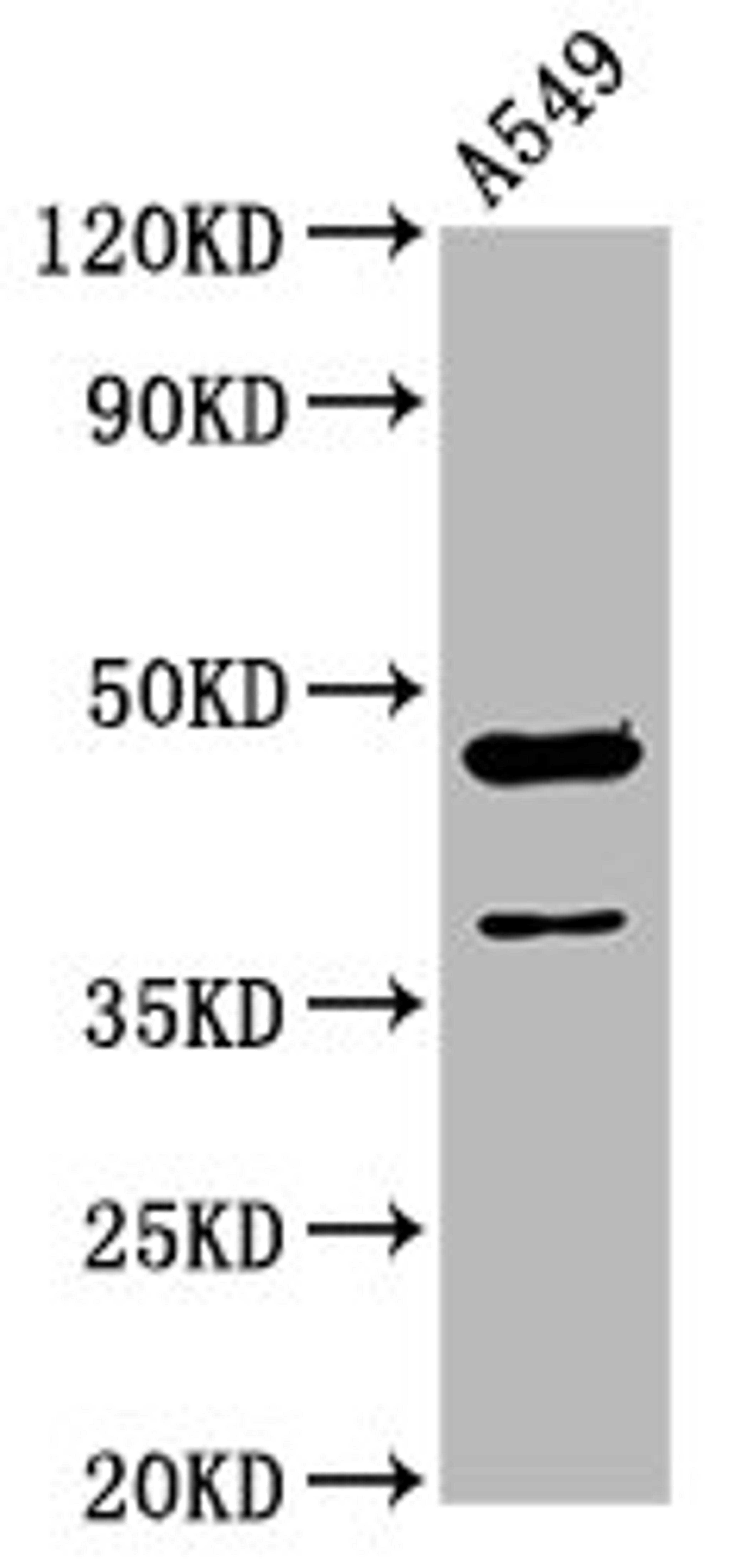Western Blot. Positive WB detected in: A549 whole cell lysate. All lanes: NR2F1 antibody at 3.4µg/ml. Secondary. Goat polyclonal to rabbit IgG at 1/50000 dilution. Predicted band size: 47 kDa. Observed band size: 47 kDa