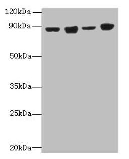 Western blot. All lanes: DDX50 antibody at 4µg/ml. Lane 1: Hela whole cell lysate. Lane 2: Jurkat whole cell lysate. Lane 3: K562 whole cell lysate. Lane 4: 293T whole cell lysate. Secondary. Goat polyclonal to rabbit IgG at 1/10000 dilution. Predicted band size: 83 kDa. Observed band size: 83 kDa
