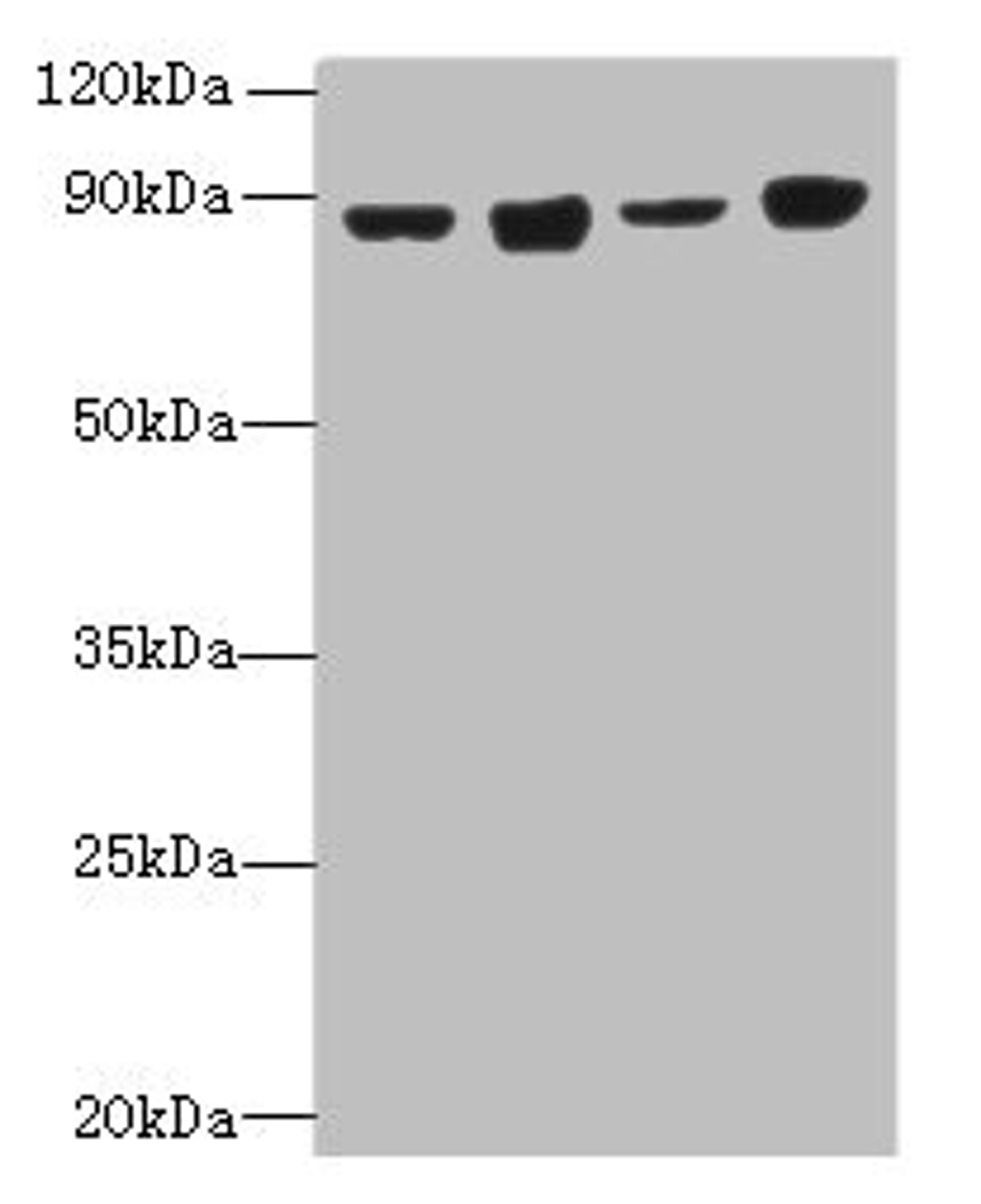 Western blot. All lanes: DDX50 antibody at 4µg/ml. Lane 1: Hela whole cell lysate. Lane 2: Jurkat whole cell lysate. Lane 3: K562 whole cell lysate. Lane 4: 293T whole cell lysate. Secondary. Goat polyclonal to rabbit IgG at 1/10000 dilution. Predicted band size: 83 kDa. Observed band size: 83 kDa