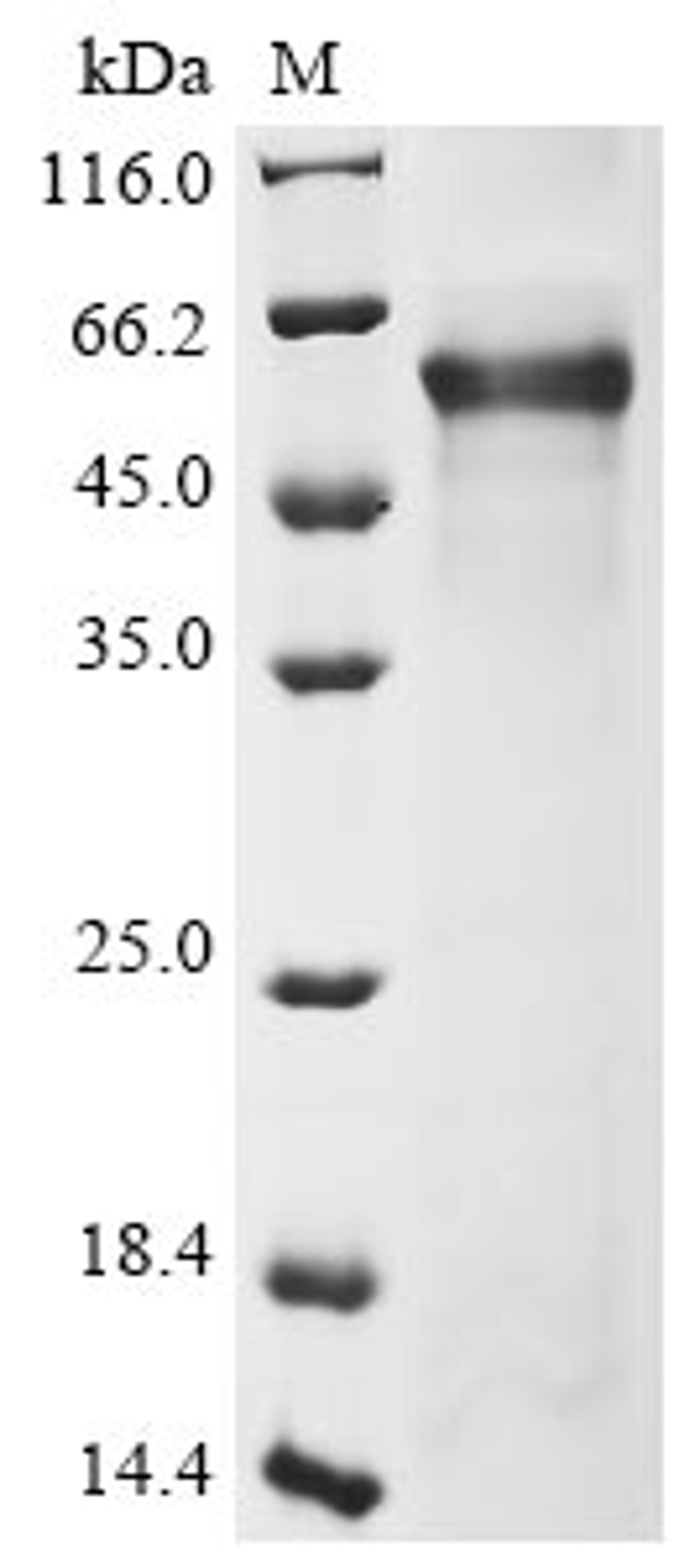 (Tris-Glycine gel) Discontinuous SDS-PAGE (reduced) with 5% enrichment gel and 15% separation gel.