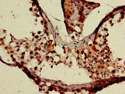 Immunohistochemistry of paraffin-embedded human testis tissue using CSB-PA764111LA01HU at dilution of 1:100