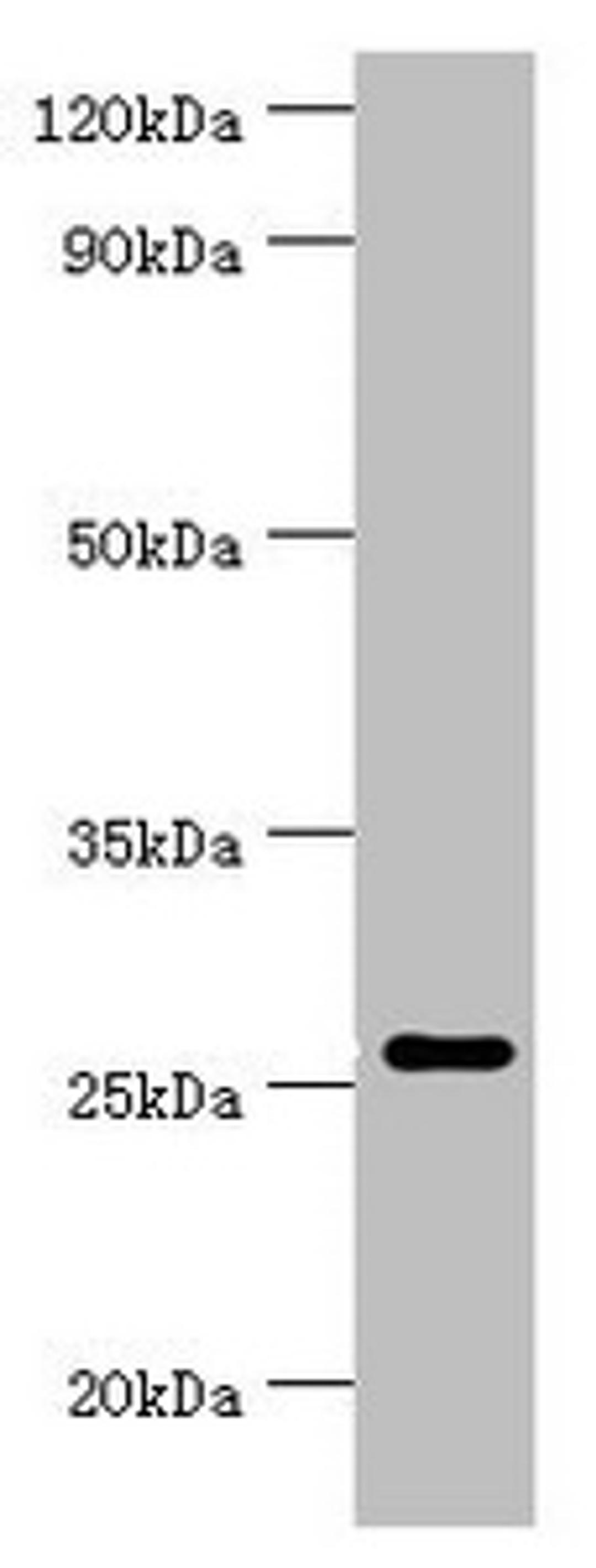 Western blot. All lanes: Tumor necrosis factor ligand superfamily member 13 antibody at 10ug/ml + Hela whole cell lysate. Secondary. Goat polyclonal to rabbit IgG at 1/10000 dilution. Predicted band size: 28, 26, 25, 37, 23 kDa. Observed band size: 28 kDa. 