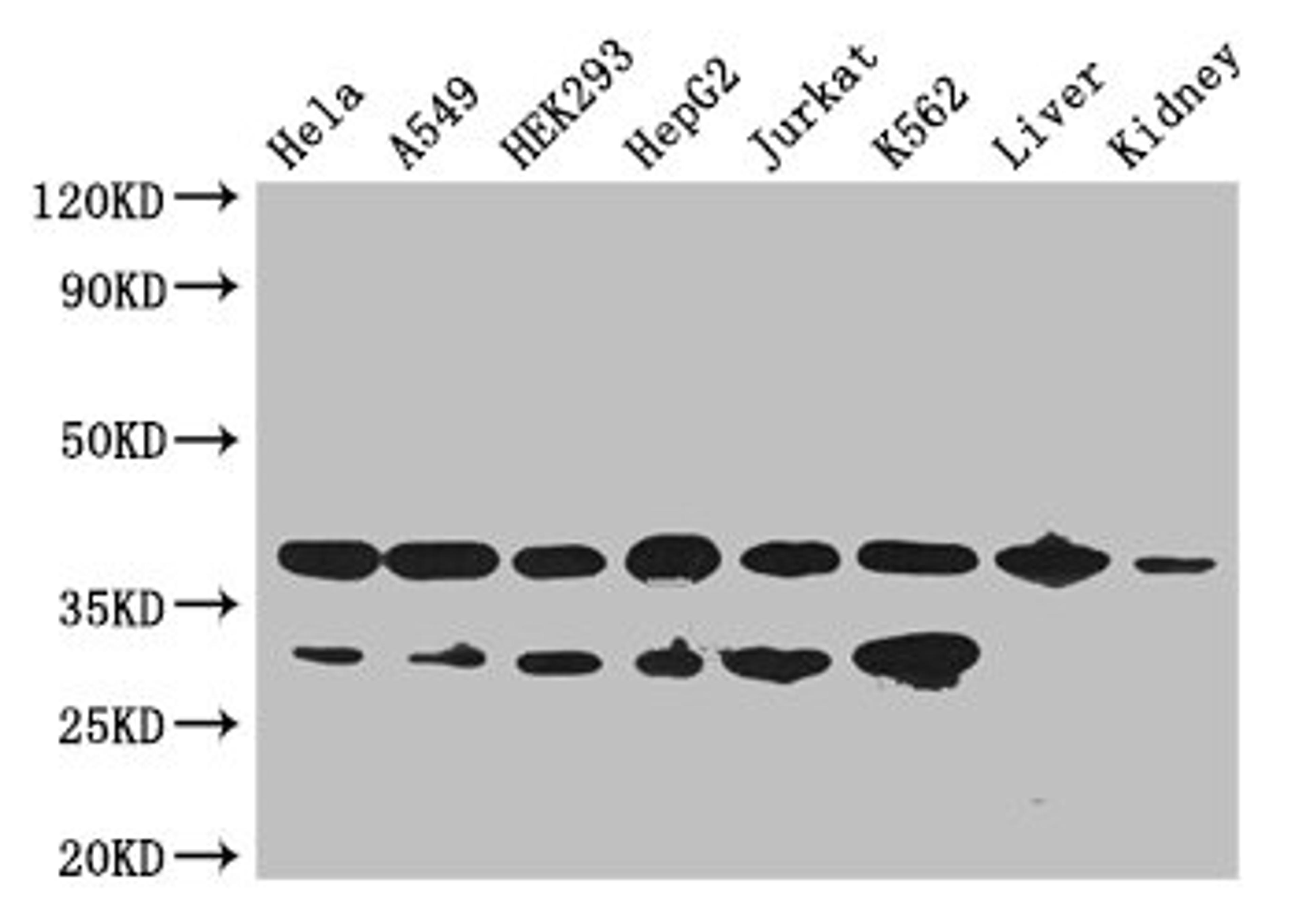 Western Blot. Positive WB detected in: Hela whole cell lysate, A549 whole cell lysate, HEK293 whole cell lysate, HepG2 whole cell lysate, Jurkat whole cell lysate, K562 whole cell lysate, Mouse liver tissue, Mouse kidney tissue. All lanes: GAPDH antibody at 2.5ug/ml. Secondary. Goat polyclonal to rabbit IgG at 1/50000 dilution. Predicted band size: 37, 32 kDa. Observed band size: 37, 32 kDa. 
