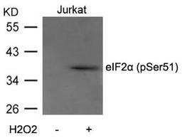 Western blot analysis of extracts from Jurkat cells untreated or treated with H2O2 using eIF2a(Phospho-Ser51) Antibody.