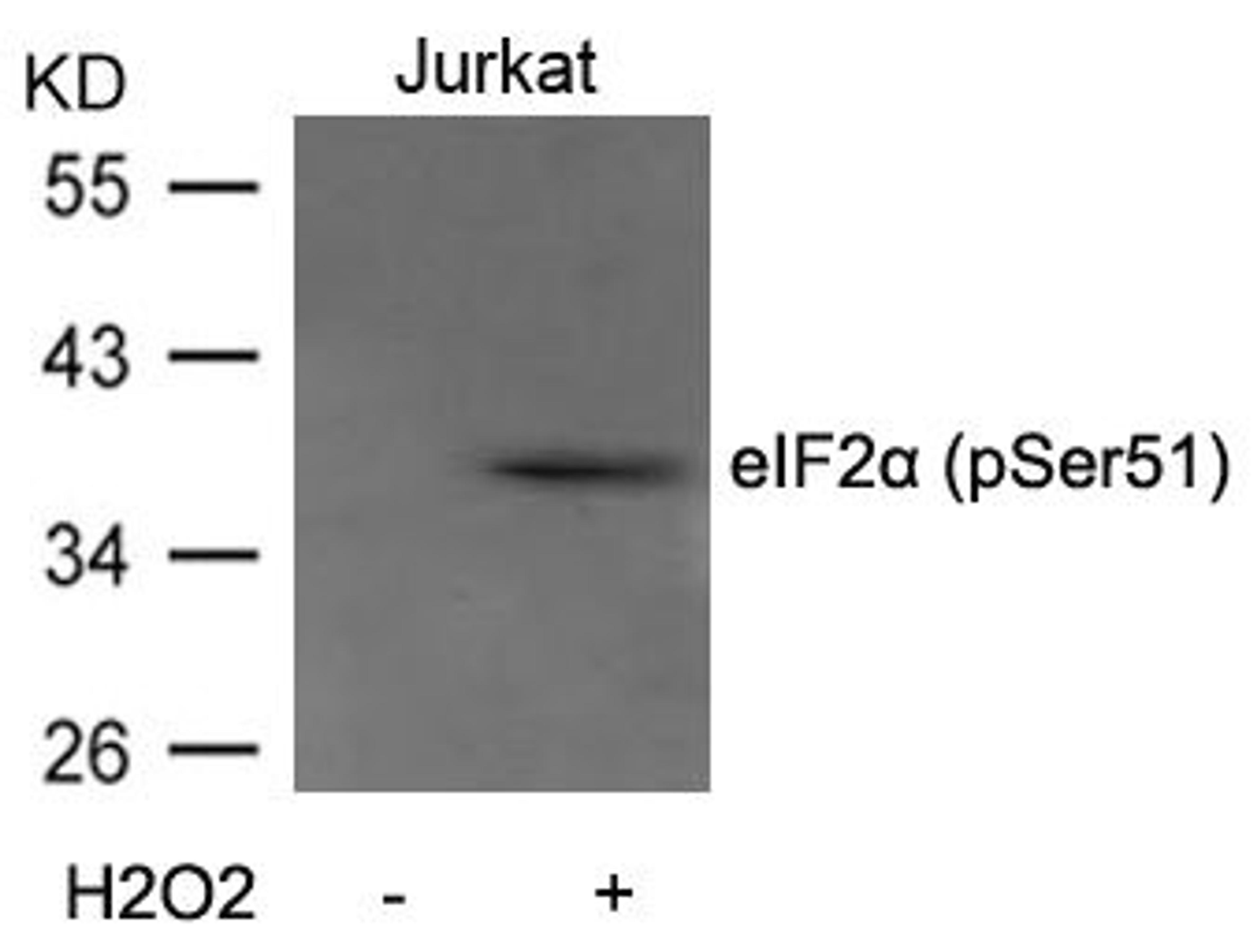 Western blot analysis of extracts from Jurkat cells untreated or treated with H2O2 using eIF2a(Phospho-Ser51) Antibody.