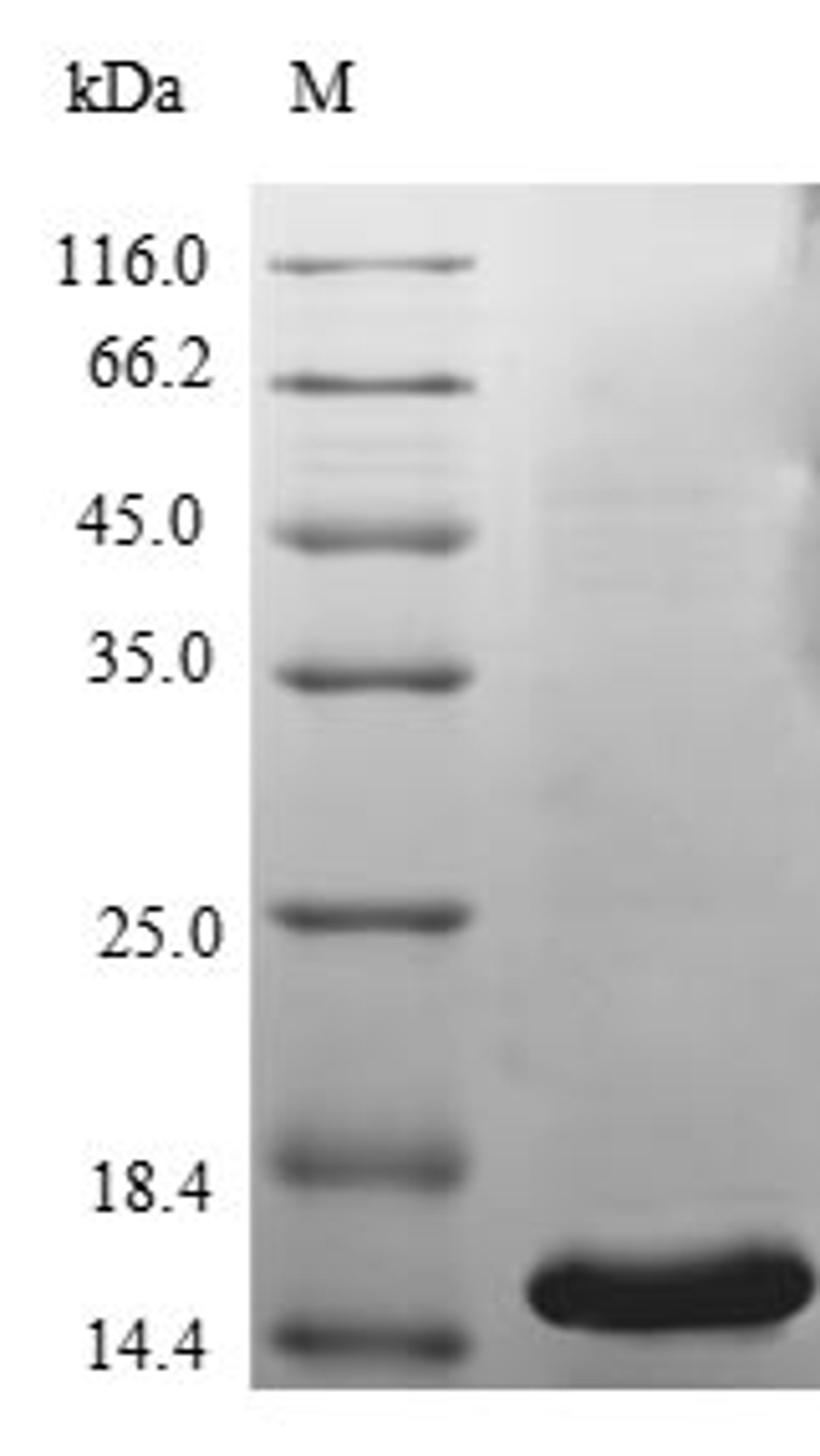 (Tris-Glycine gel) Discontinuous SDS-PAGE (reduced) with 5% enrichment gel and 15% separation gel.