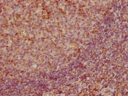 IHC image of CSB-RA859522A0HU diluted at 1:155 and staining in paraffin-embedded human tonsil tissue performed on a Leica BondTM system. After dewaxing and hydration, antigen retrieval was mediated by high pressure in a citrate buffer (pH 6.0). Section was blocked with 10% normal goat serum 30min at RT. Then primary antibody (1% BSA) was incubated at 4℃ overnight. The primary is detected by a biotinylated secondary antibody and visualized using an HRP conjugated SP system.