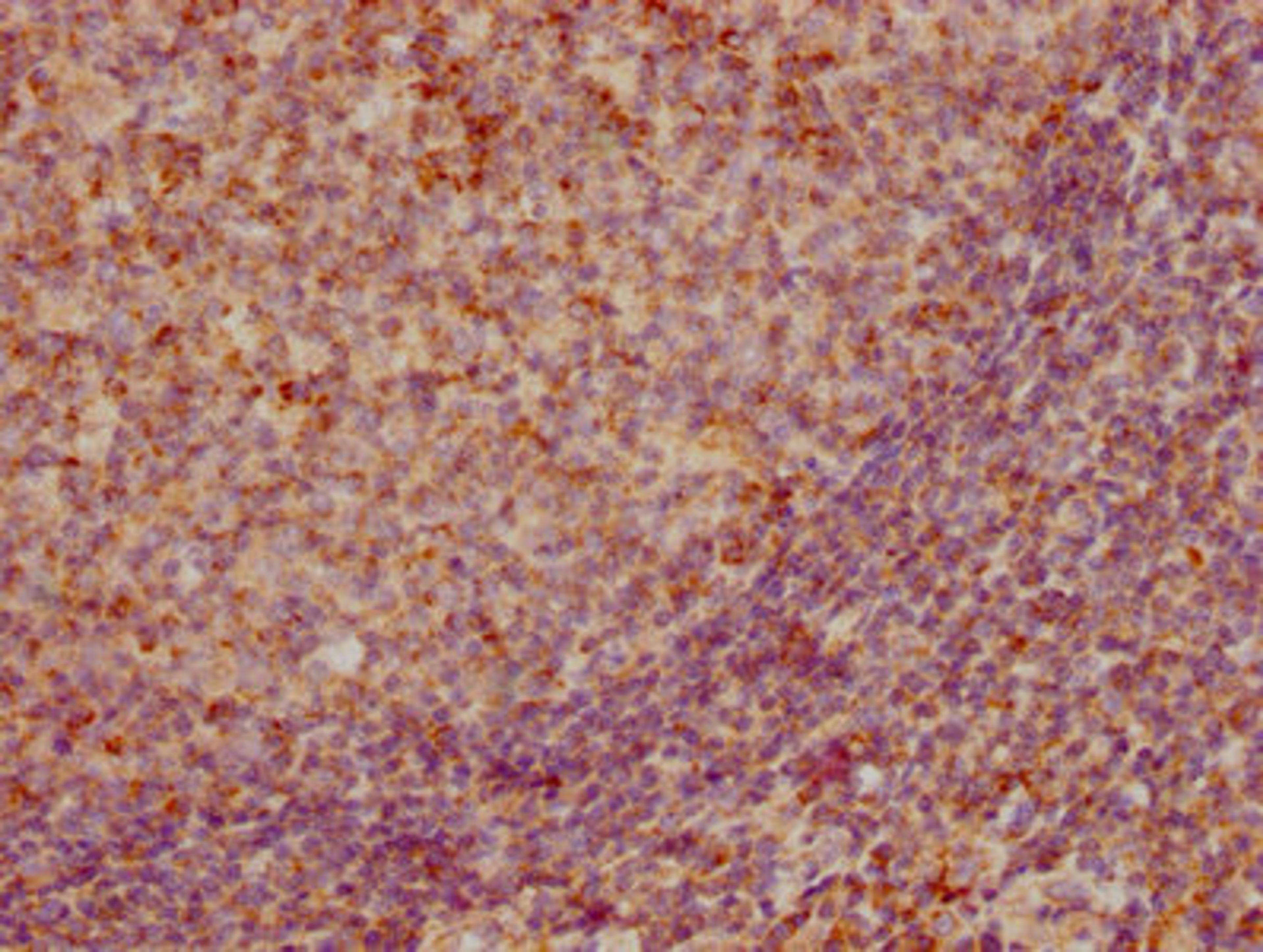 IHC image of CSB-RA859522A0HU diluted at 1:155 and staining in paraffin-embedded human tonsil tissue performed on a Leica BondTM system. After dewaxing and hydration, antigen retrieval was mediated by high pressure in a citrate buffer (pH 6.0). Section was blocked with 10% normal goat serum 30min at RT. Then primary antibody (1% BSA) was incubated at 4℃ overnight. The primary is detected by a biotinylated secondary antibody and visualized using an HRP conjugated SP system.