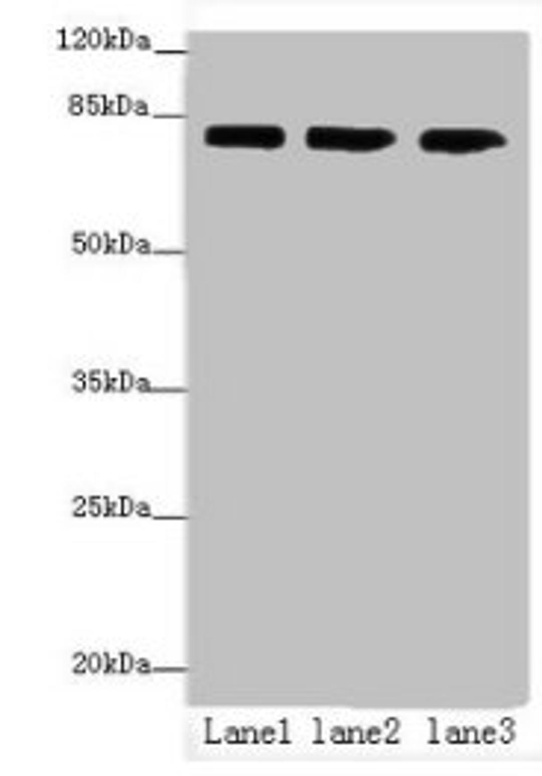 Western blot. All lanes: AP4B1 antibody at 3ug/ml. Lane 1: HepG2 whole cell lysate. Lane 2: U251 whole cell lysate. Lane 3: LO2 whole cell lysate. Secondary. Goat polyclonal to rabbit IgG at 1/10000 dilution. Predicted band size: 84, 35 kDa. Observed band size: 84 kDa. 