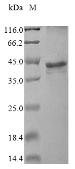 (Tris-Glycine gel) Discontinuous SDS-PAGE (reduced) with 5% enrichment gel and 15% separation gel.