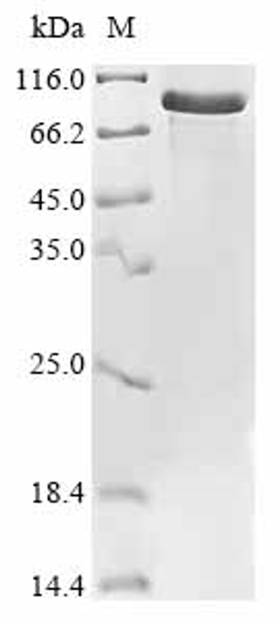 (Tris-Glycine gel) Discontinuous SDS-PAGE (reduced) with 5% enrichment gel and 15% separation gel.