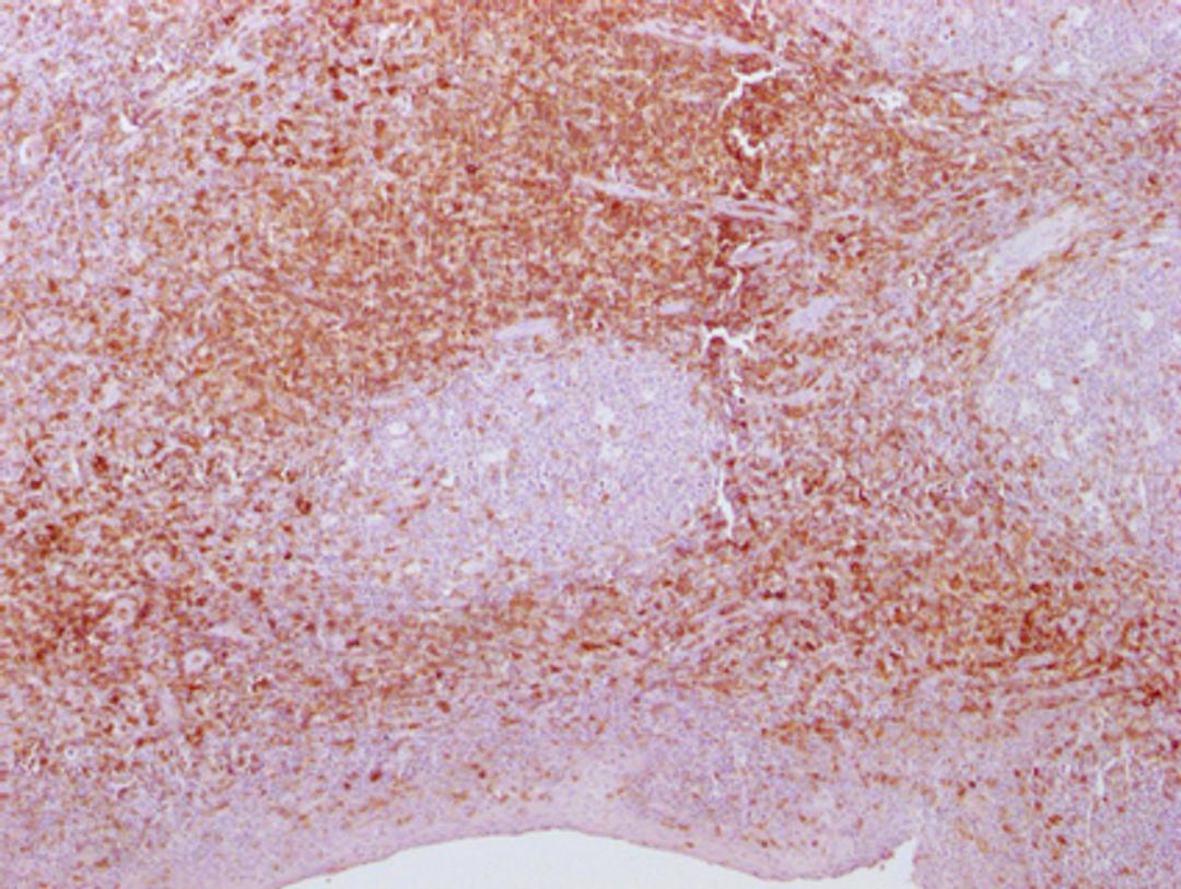 IHC image of CSB-MA269399 diluted at 1:100 and staining in paraffin-embedded human tonsil tissue performed on a Leica BondTM system. After dewaxing and hydration, antigen retrieval was mediated by high pressure in a citrate buffer (pH 6.0). Section was blocked with 10% normal goat serum 30min at RT. Then primary antibody (1% BSA) was incubated at 4°C overnight. The primary is detected by a Goat anti-mouse IgG polymer labeled by HRP and visualized using 0.05% DAB.