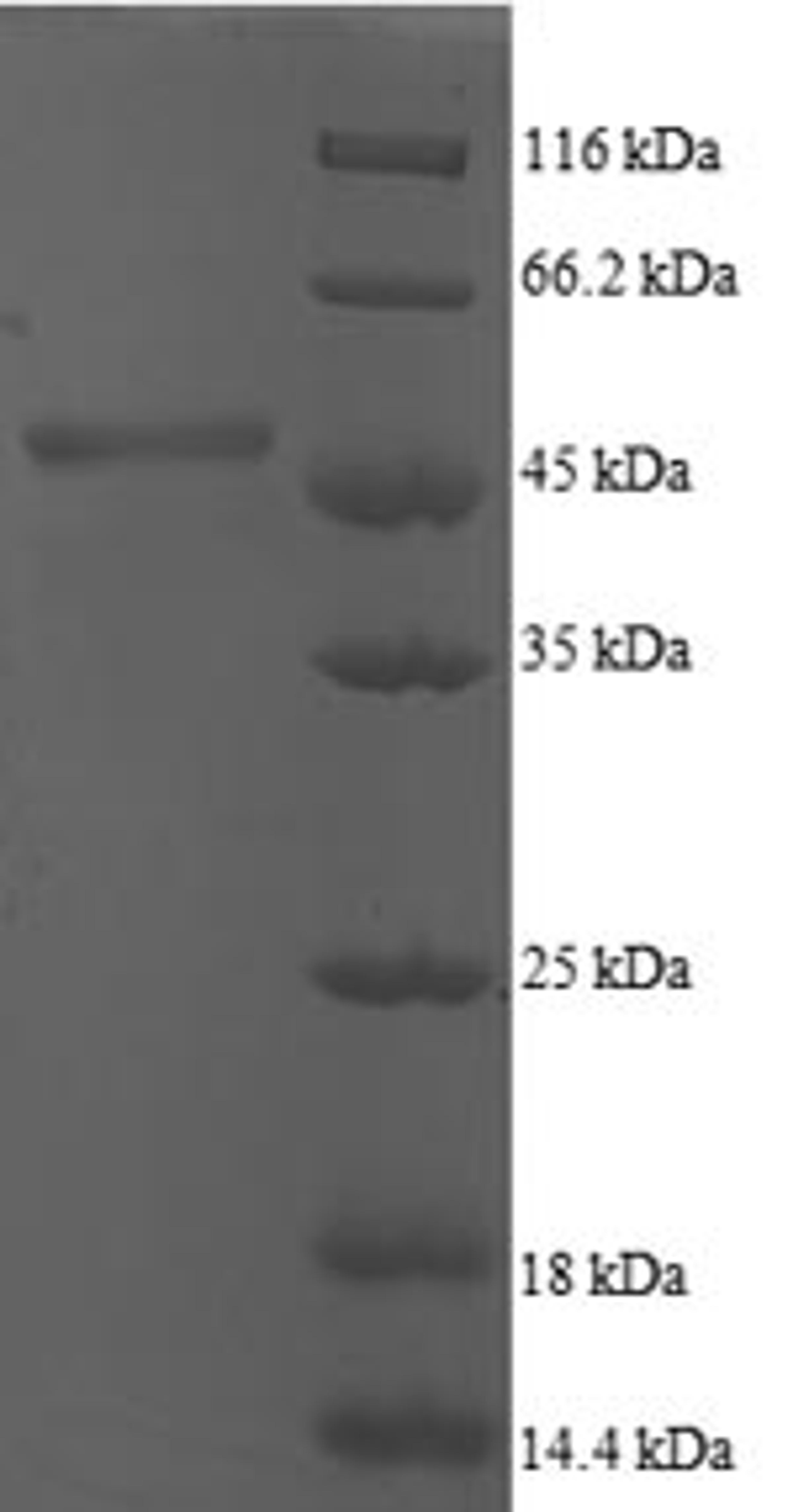 (Tris-Glycine gel) Discontinuous SDS-PAGE (reduced) with 5% enrichment gel and 15% separation gel.