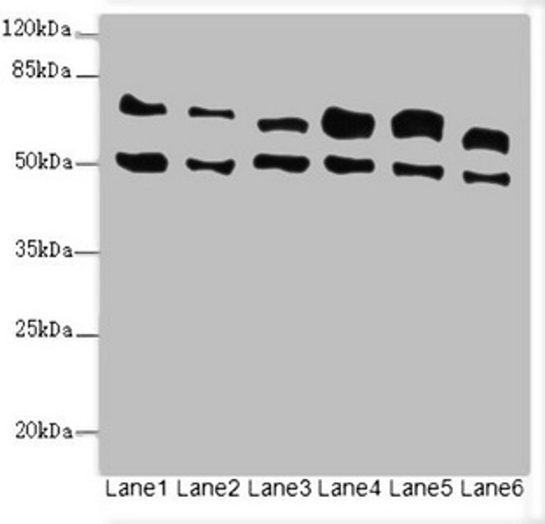 Western blot. All lanes: ELF2 antibody at 3.35ug/ml. Lane 1: HL60 whole cell lysate. Lane 2: A549 whole cell lysate. Lane 3: MCF-7 whole cell lysate. Lane 4: Jurkat whole cell lysate. Lane 5: Hela whole cell lysate. Lane 6: Mouse lung tissue. Secondary. Goat polyclonal to rabbit IgG at 1/10000 dilution. Predicted band size: 64, 63, 57, 58, 55 kDa. Observed band size: 64, 50 kDa. 